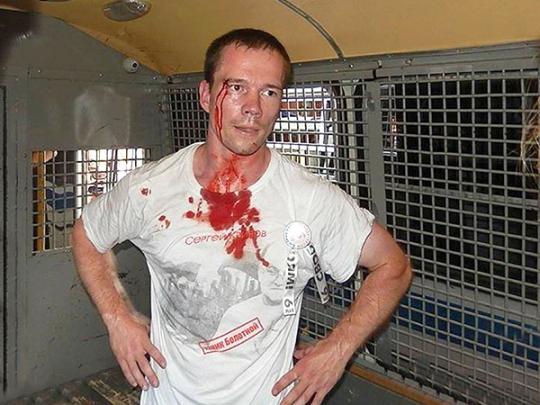 Ильдар Дадин: Я уже чувствовал, что не выдерживаю боль... В этот момент я сломался (видео)