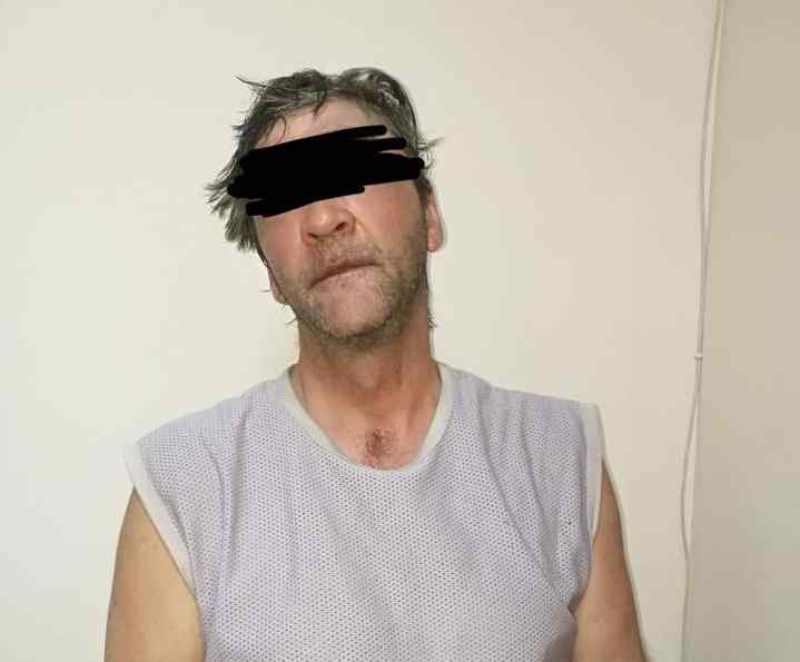 В Одессе сосед брызнул ребенку кислотой в лицо