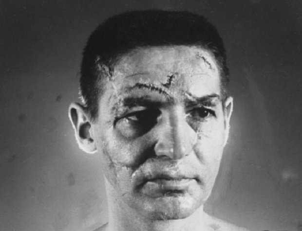 40 шрамов на лице, алкоголизм и затяжные депрессии: какой ценой Терри Савчук стал звездой хоккея