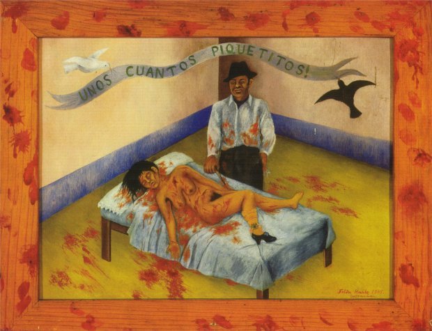 Наркотики, любовницы и хроническая боль: история художницы-бунтарки с ампутированной ногой