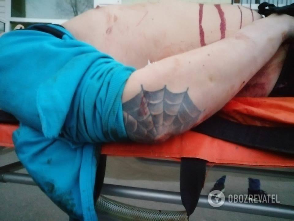 В центре Киева устроили стрельбу в жилом доме: подробности смертельного ЧП и фото