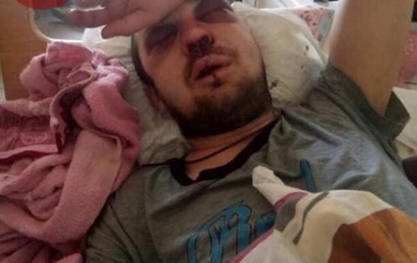 Водитель киевской маршрутки жестоко избил пассажира