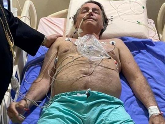 Президент Бразилії потрапив до лікарні після десятиденного нападу гикавки