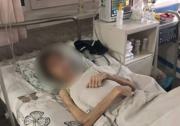 Как живет 16-летний одессит, которого чуть не заморили голодом
