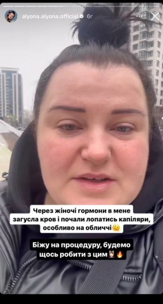 «Просто якась напасть»: учасниця «Євробачення» від України розповіла, як лікується від недугів перед конкурсом